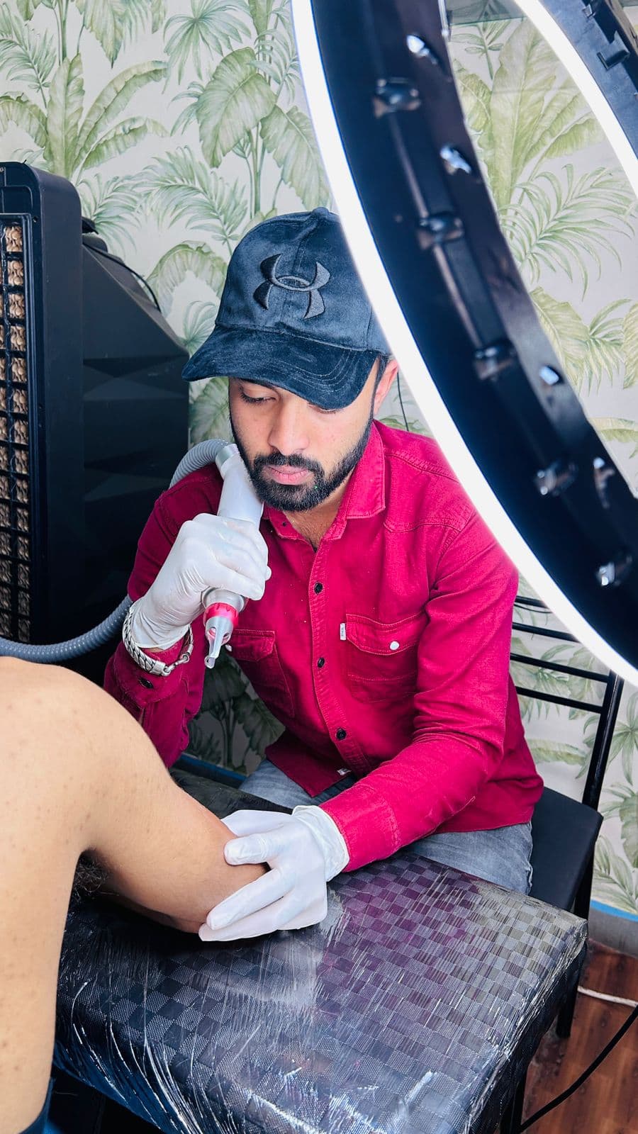 Tattoo Removal